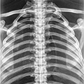 Fantôme corps entier pour radiographie - os humain 7